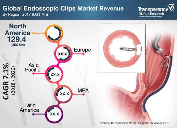 global endoscopic  clips market